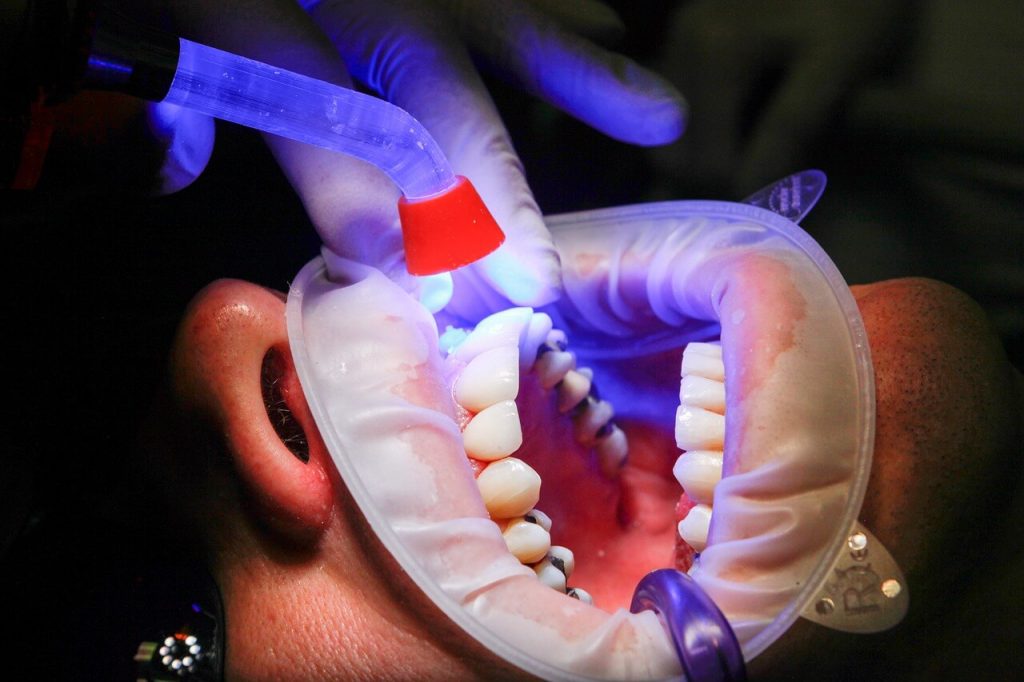Khử khuẩn phòng khám tia UV