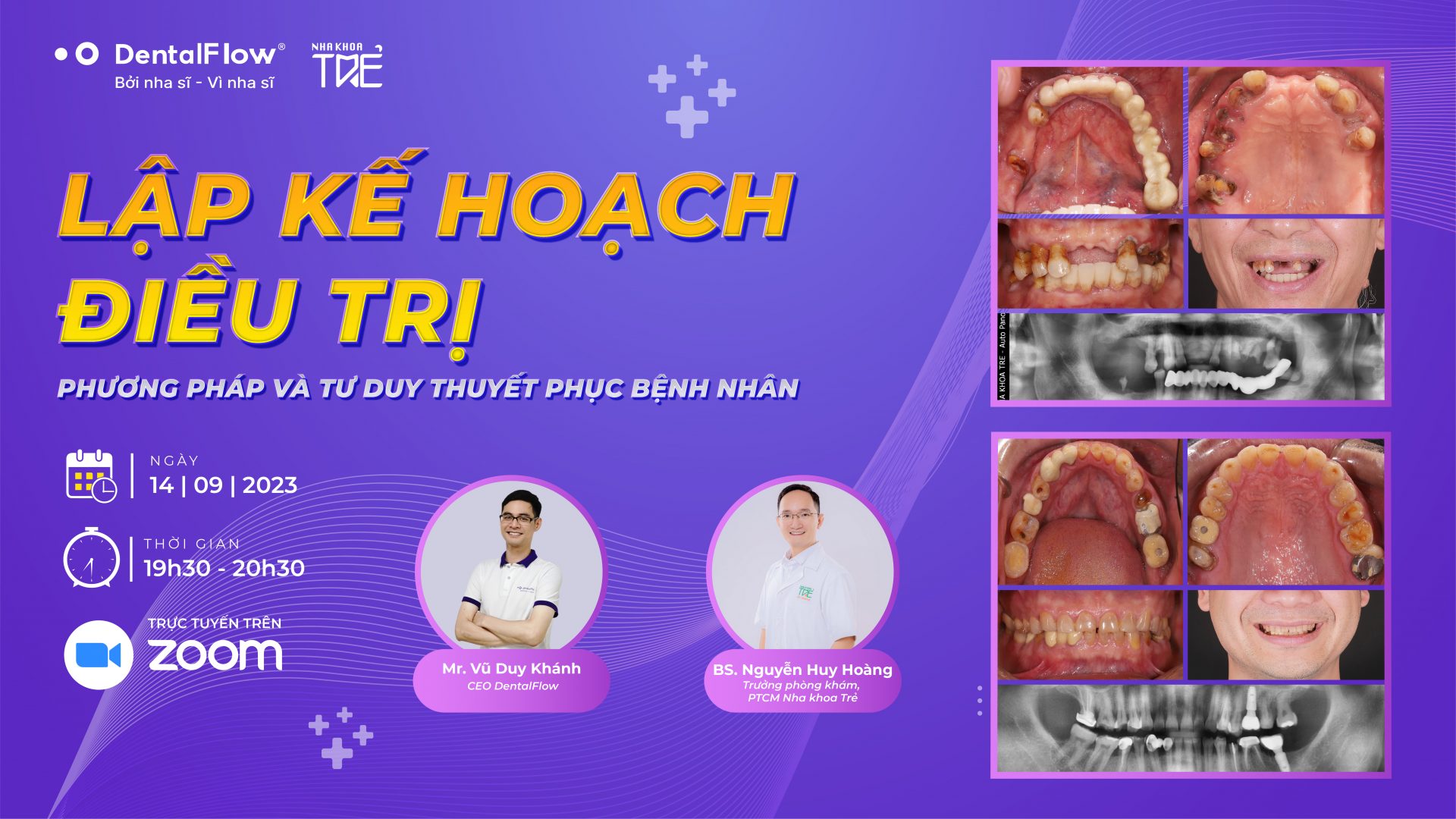 Bùng nổ tháng 9 với Webinar: Lập kế hoạch điều trị – Phương pháp và tư duy thuyết phục bệnh nhân cùng Dr. Huy Hoàng (Nha khoa Trẻ)